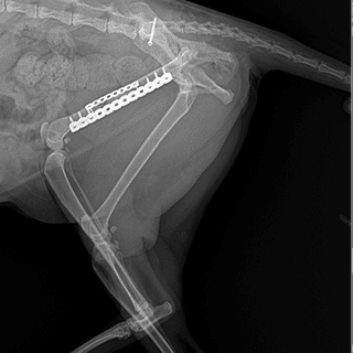 골절·각기형 센터